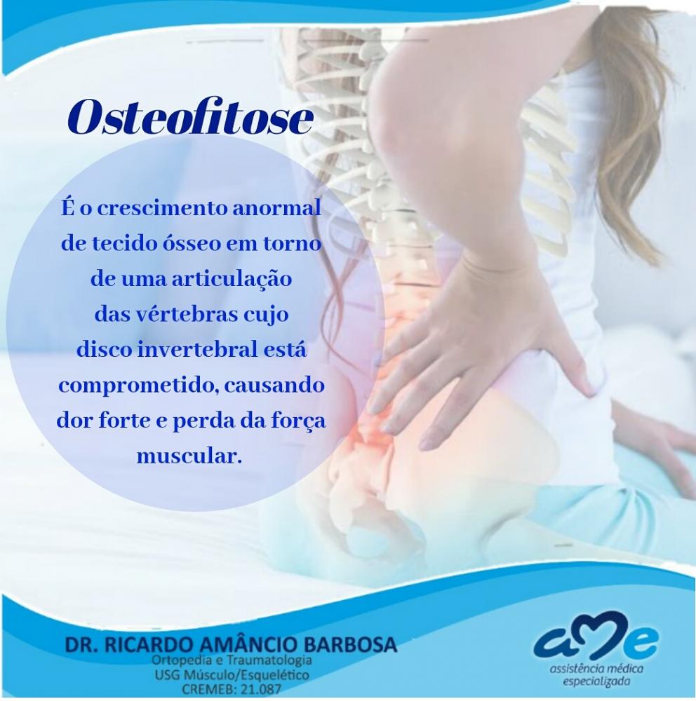 Drº Ricardo Barbosa ortopedista e traumatologista explica o que é Osteofitose