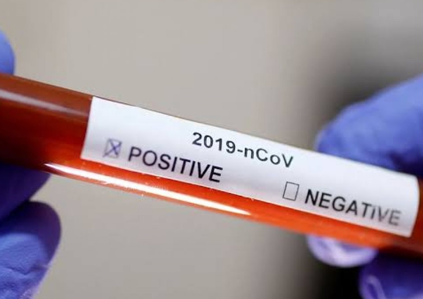 Número sobe e mais de 21% dos infectados por Covid-19 na Bahia estão curados
