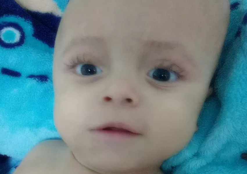 Tristeza em Brumado: Bryan Loran, de 2 anos, diagnosticado com hidrocefalia, morre no hospital