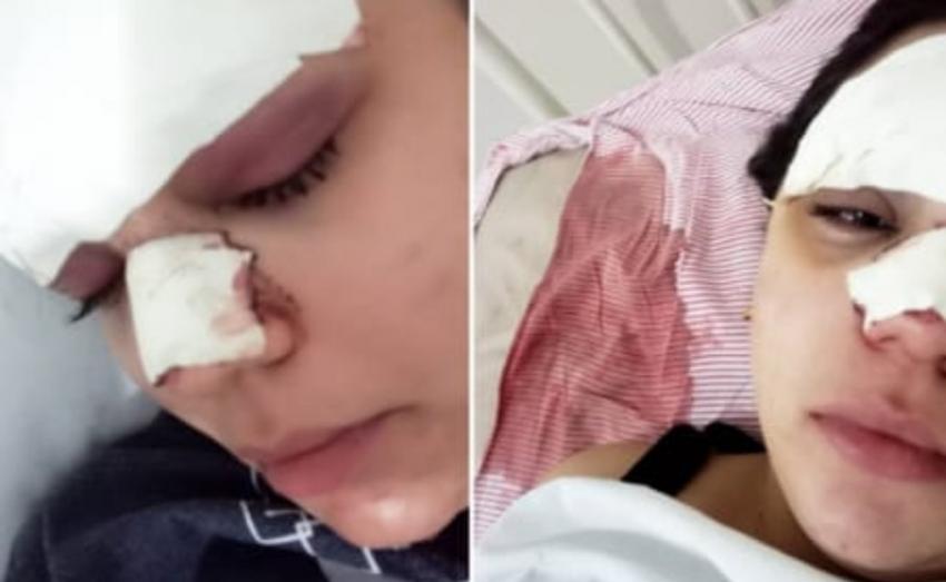 Barra da Estiva: Jovem tem cortes e hematomas no rosto após ser agredida e família denuncia amigo: 'Que não fique impune', diz irmã