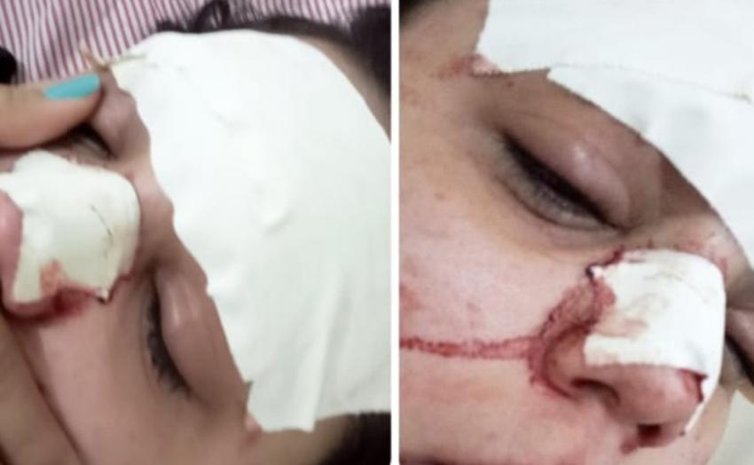 Barra da Estiva: Jovem tem cortes e hematomas no rosto após ser agredida e família denuncia amigo: 'Que não fique impune', diz irmã