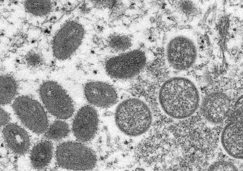 Bahia registra primeiro caso suspeito da Varíola do Macaco