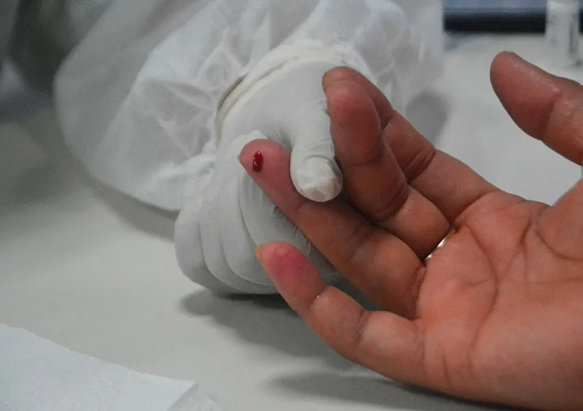 Casos de hepatite A aumentam 400% na Bahia em cinco anos