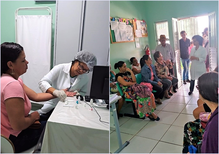 Julho Amarelo:  Unidade Básica da Família de Livramento realiza teste de hepatites B e C e de HIV gratuito