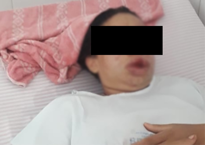 Brumado: Acusado de espancar jovem de 23 anos responderá processo em liberdade
