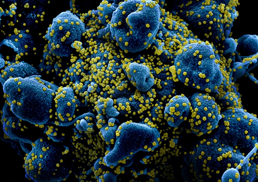 Bahia contabiliza 1.249 pacientes infectados pelo coronavírus e 45 mortes