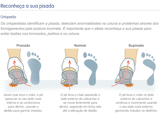  Dicas de Dr. Ricardo Barbosa sobre o tipo de pisada