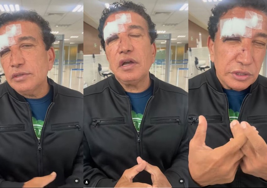 Conquista: Magno Malta é hospitalizado com ferimentos no rosto após vidro de banheiro de hotel quebrar