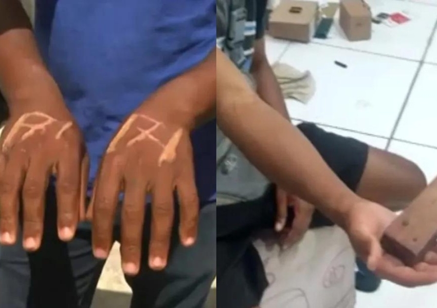 Empresário e gerente suspeitos de queimar mãos de funcionários em Salvador são indiciados por tortura