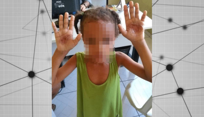 Mulher é presa após queimar mãos de criança e alegar punição por "mau comportamento"