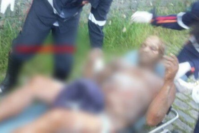 Itabuna: Morador de rua morre após ter o corpo incendiado