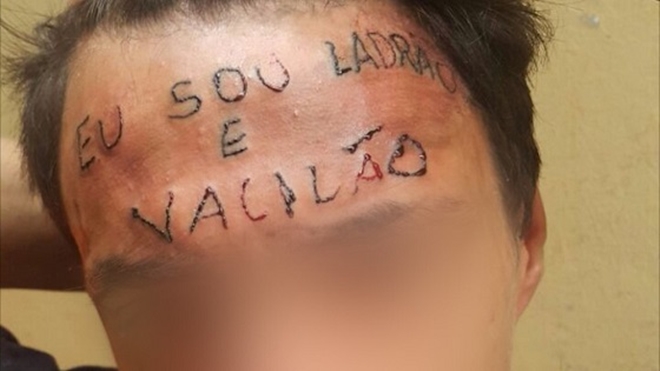 Universidade se oferece para retirar tatuagem da testa de jovem