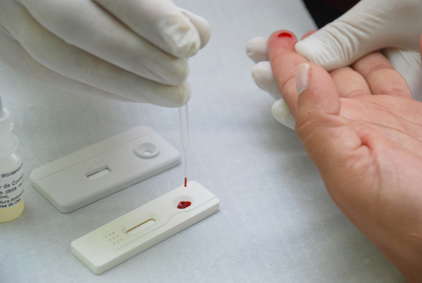 Folião que identificar vírus HIV no Carnaval já sairá com medicamento
