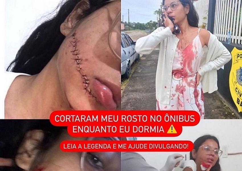 Moradora de Itabuna é cortada no rosto enquanto dormia em ônibus interestadual