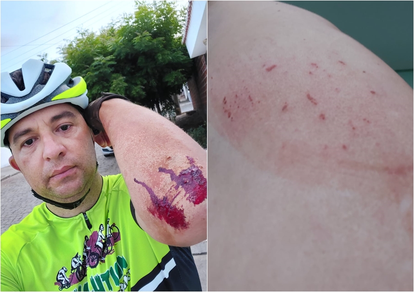 Após ser atropelado ciclista relata ter sido agredido
